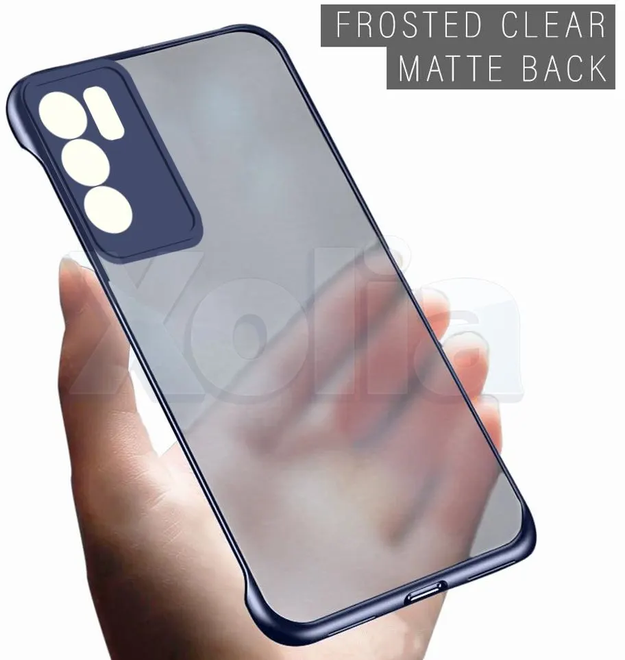 Xolia Back Cover for Oppo Reno 6 5G (Blue, Plastic, Pack of: 1) — image 5 of 5