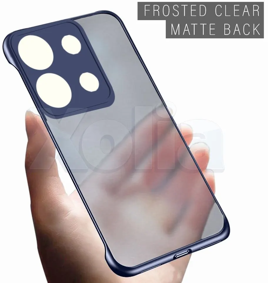 Xolia Back Cover for Redmi Note 13 5G (Blue, Plastic, Pack of: 1) — image 5 of 5