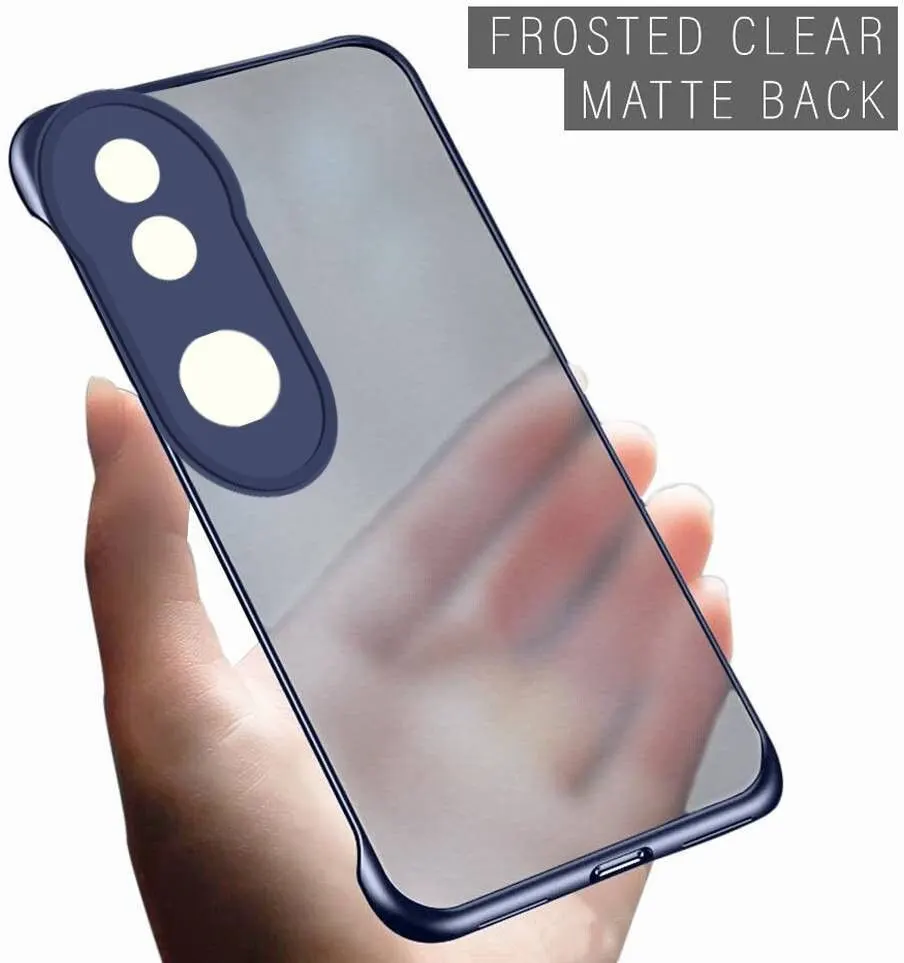 Micvir Back Cover for iQOO Z10R 5G (Blue, Plastic, Pack of: 1) — image 5 of 5